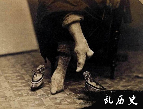 中国古代女子缠足的历史：清末可骇的女人缠足照