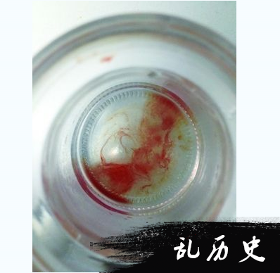 滴血认亲真的有用吗