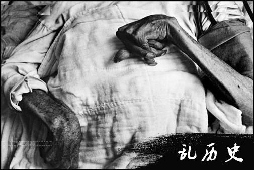 汞中毒这么可怕！日本水俣病事件