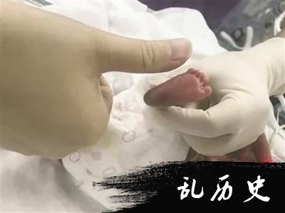 24小时“一对一”特护，袋鼠式护理